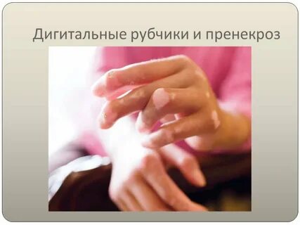 Дигитальный