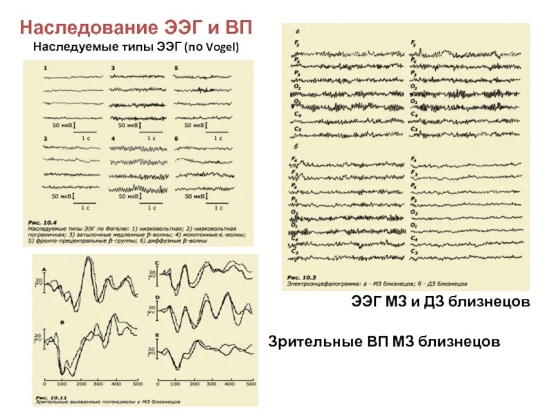 ЭЭГ волны. Фаст Активити на ЭЭГ. Лямбда волны на ЭЭГ. Типы ЭЭГ.