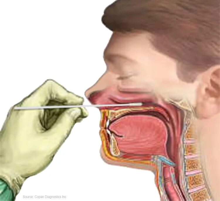 Чувствительность глотки. Взятие для взятия мазка из зева. 2. Техника забора мазка из носоглотки на менингококк.. Взятие мазка из зева и носа.