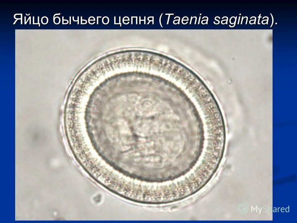 Яйцо бычьего цепня. Строение онкосферы бычьего цепня. Онкосфера свиной цепень. Яйца гельминтов бычьего цепня. Яйцо бычьего цепня.
