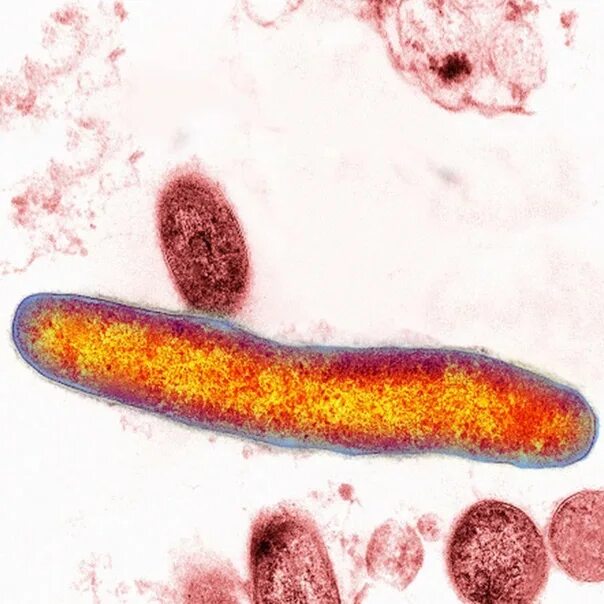 Палочка коха заболевание. Микобактерия туберкулеза палочка Коха. Палочка Коха возбудитель туберкулеза. Туберкулеза бациллы Коха.