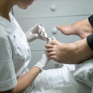 Подологический педикюр что это