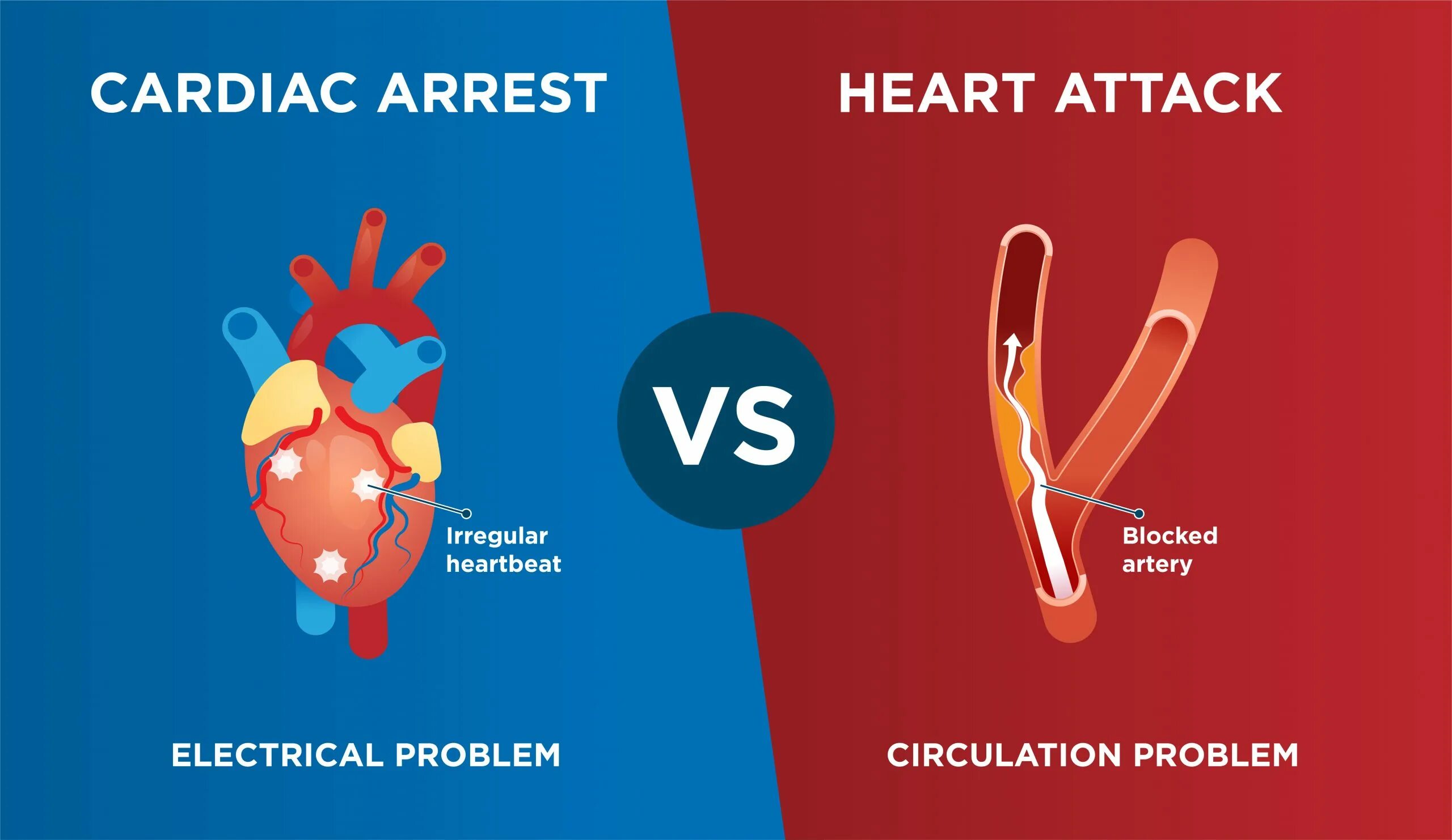 Heart attack speed up. Cardiac arrest. heart attack. heart attack symptoms.