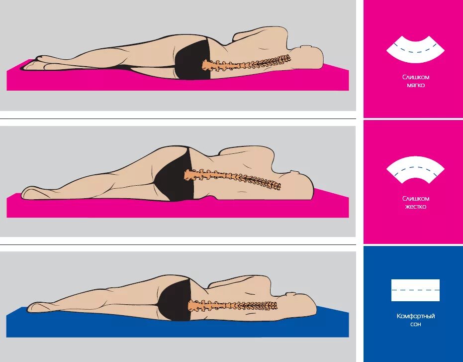 Поясница матрас. Правильные позы для сна при остеохондрозе. Правильное положение для сна. Правильное положение при сне. Правильное положение позвоночника во сне.