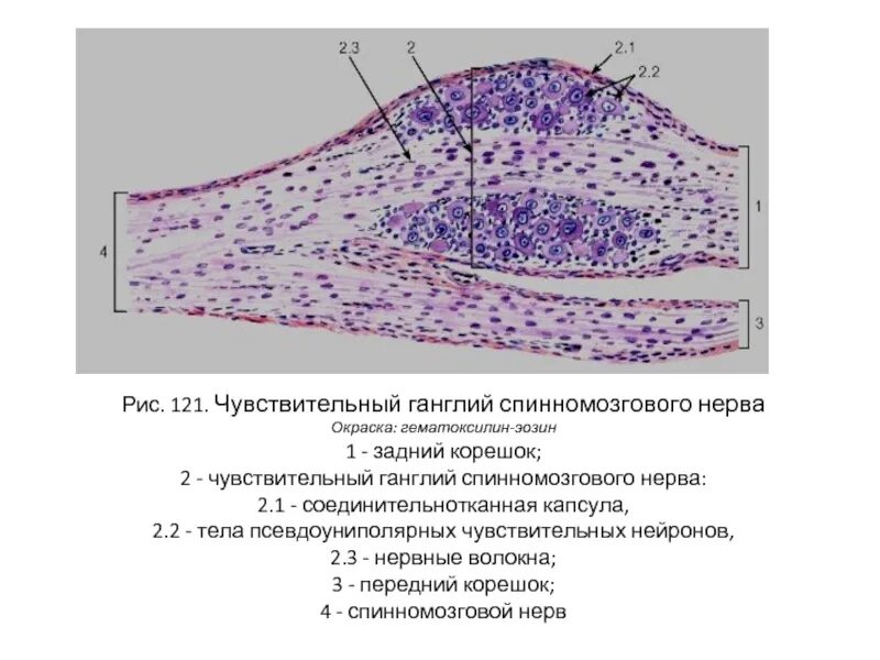 Спинномозговой чувствительный узел