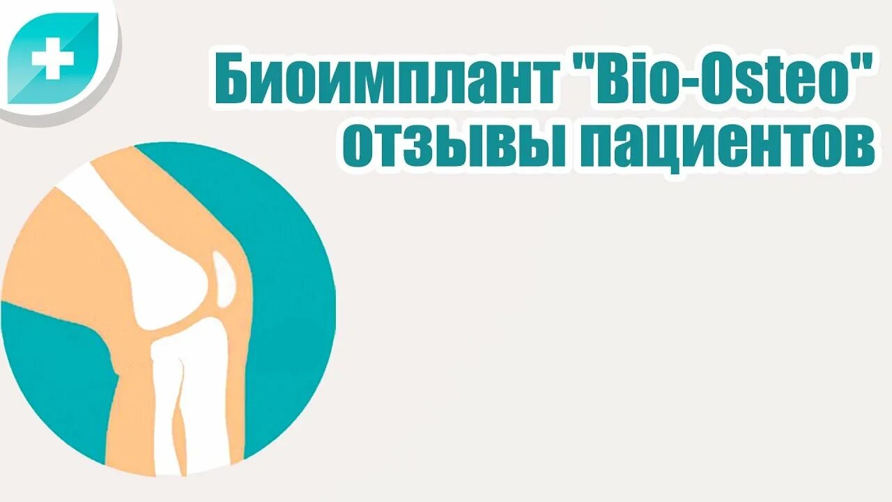 Биоимплант суставов спб. Биоимплант тазобедренного сустава. Биоимплант коленного сустава. Биоимплант “Bio-Osteo” Хабаровске.
