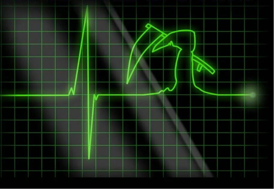 Пульс остановился. Пульс умирающего человека. Прямая линия на кардиограмме. Пульс остановился. Пульс умирающего человека.