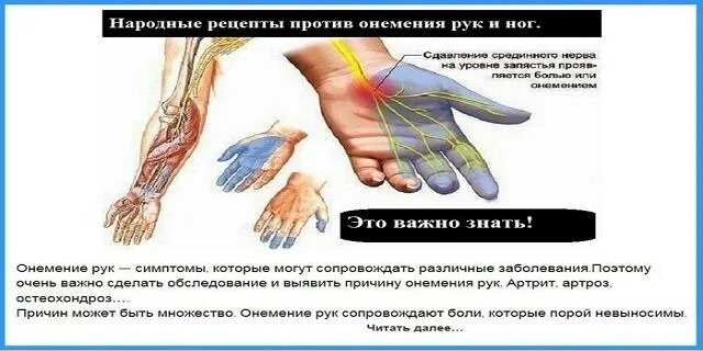 Лечение онемения конечностей рук. Онемение пальцев рук при остеохондрозе. онемение рук при остеохондрозе.