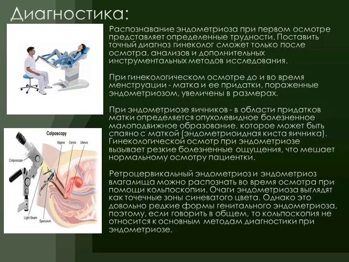 Эндометриоз диагностика. Клинические проявления эндометриоза. Матка увеличена причины при осмотре у гинеколога