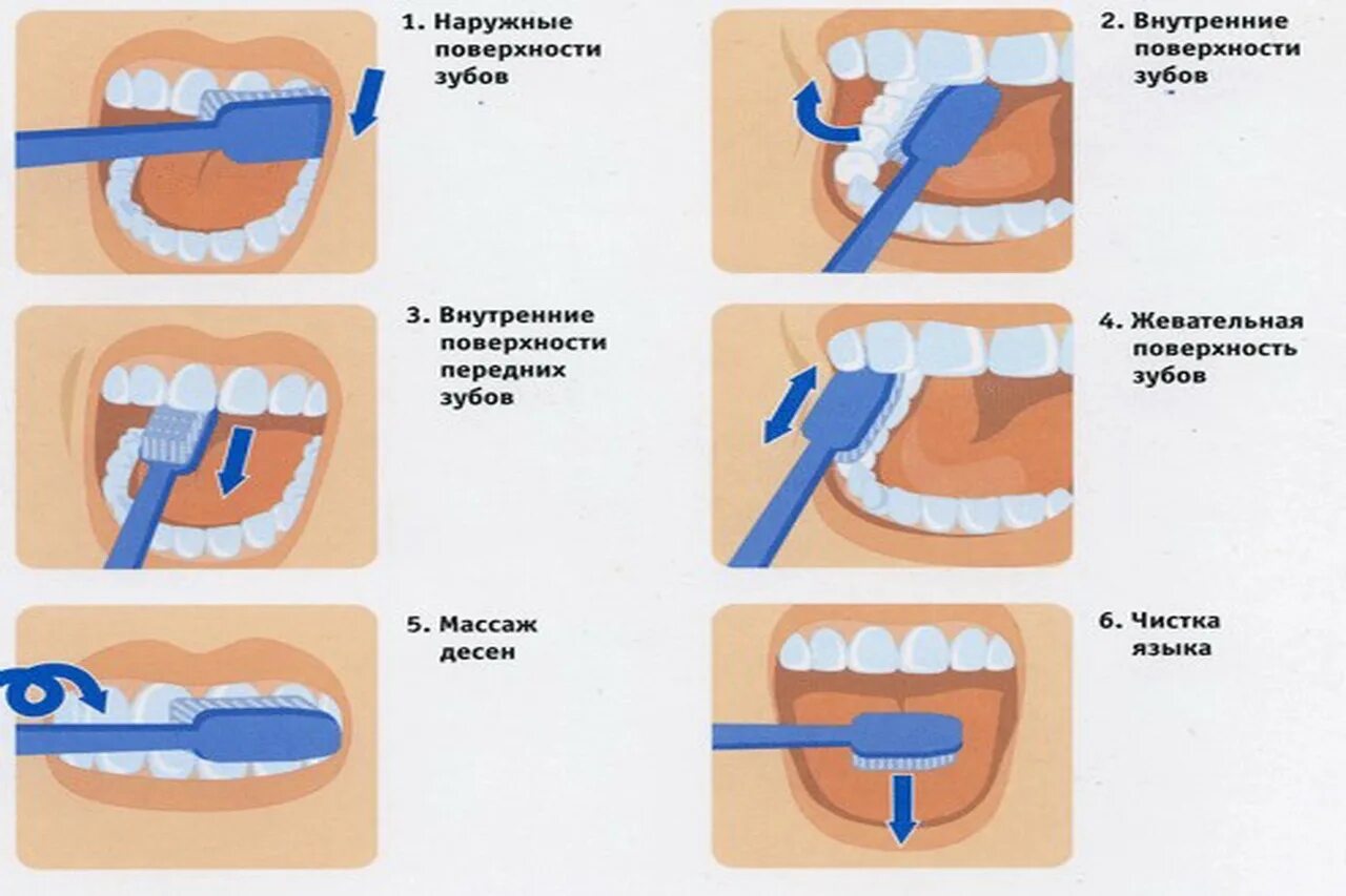Можно чистить зубы в уразу. Метод чистки зубов МГМСУ. Стандартный метод чистки зубов схема. Правильно чистить зубы. Правильная чистка зубов.