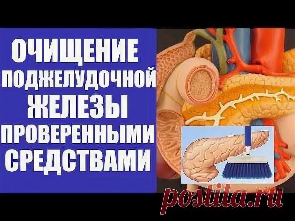 Удаляют ли поджелудочную железу полностью. Очистка поджелудочной. Почистить поджелудочную. Очищение поджелудочной железы. Как очистить поджелудочную железу.