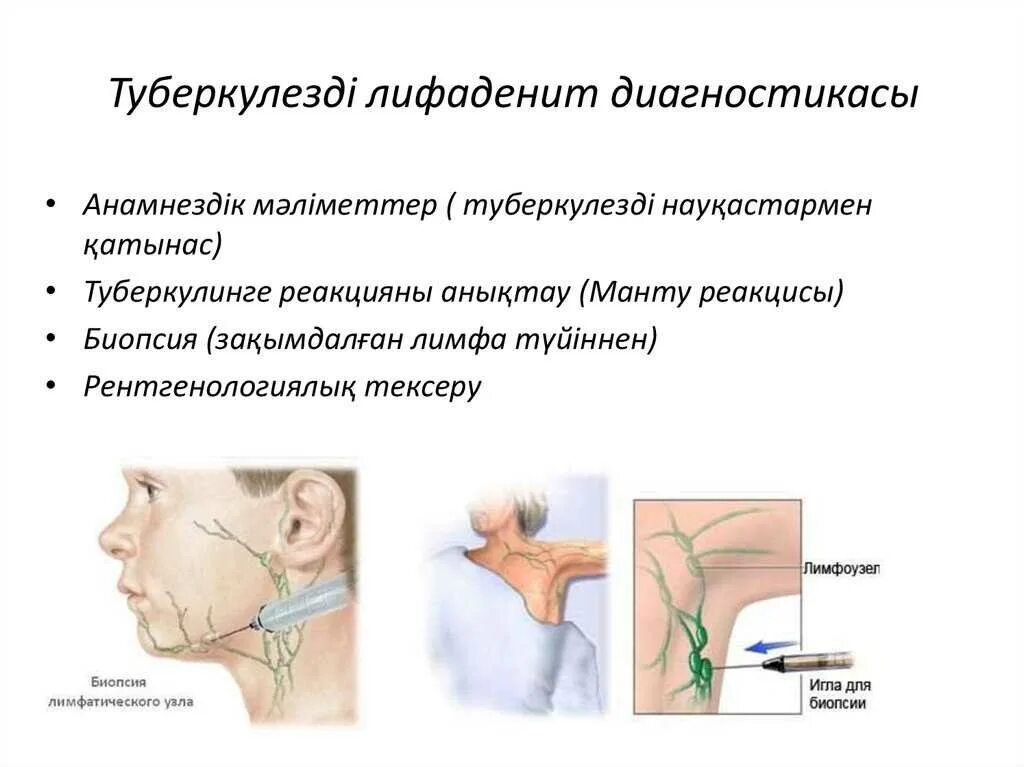 Лимфоузлы гиперплазированы