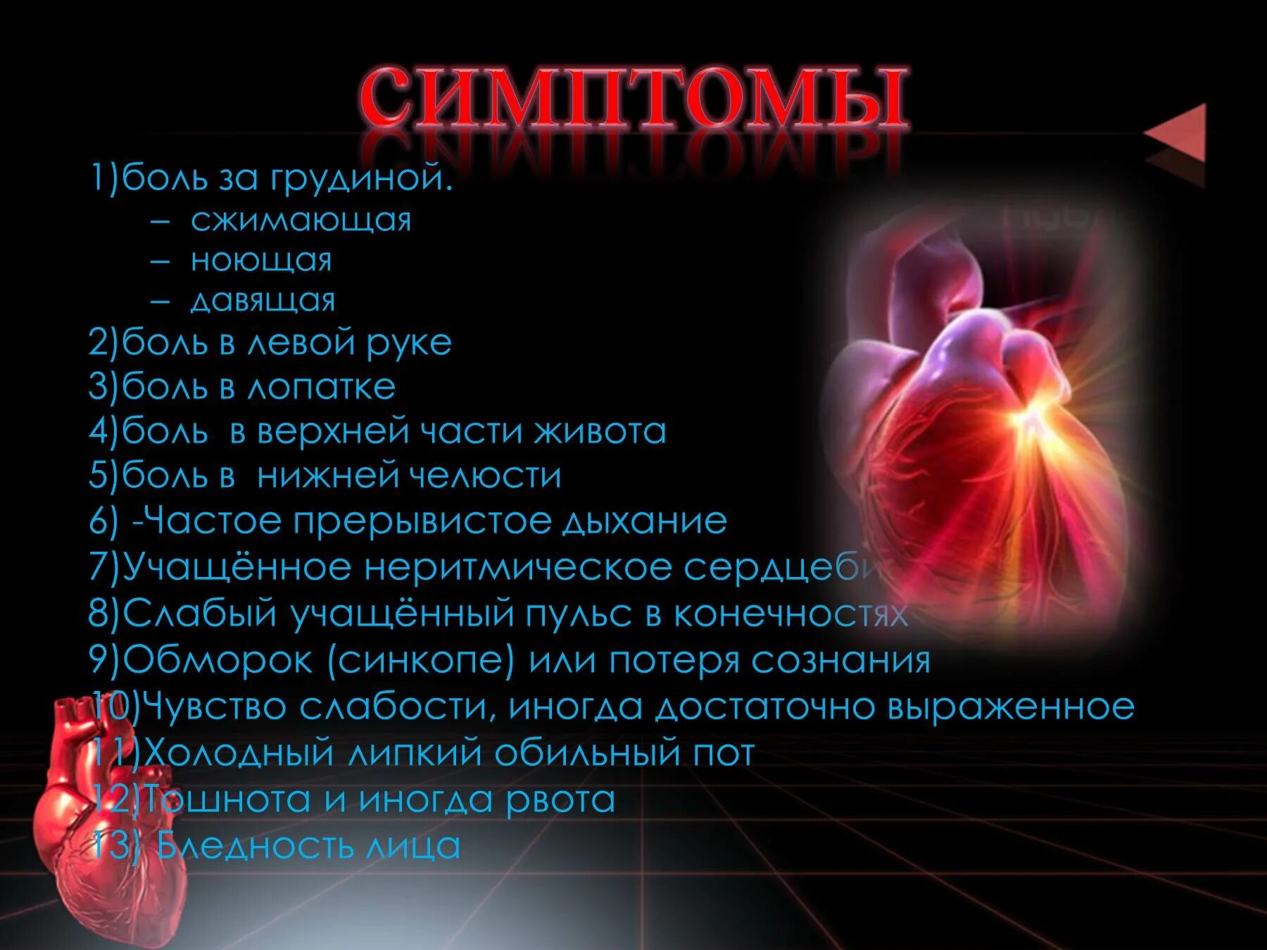 Давящая боль. Презентация на тему инфаркт миокарда. Презентация на тему острый инфаркт миокарда. Презентация миокарда инфаркт миокарда.