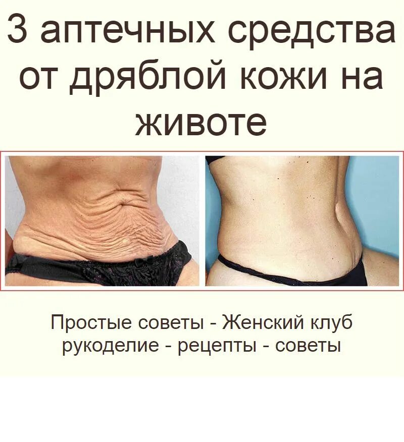 Дряблая кожа на животе как подтянуть. Средства от дряблой кожи на животе. от дряблости кожи живота. средство от дряблой кожи.