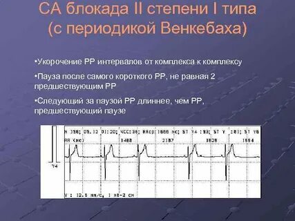 Са блокада тип 1 1 степень
