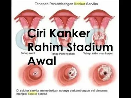 Software perawan