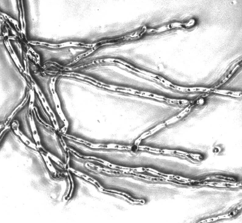 Candida albicans мицелий. Бластоспоры кандида. Candida Auris микроскопия. Грибы Candida под микроскопом. Мицелий грибов на коже