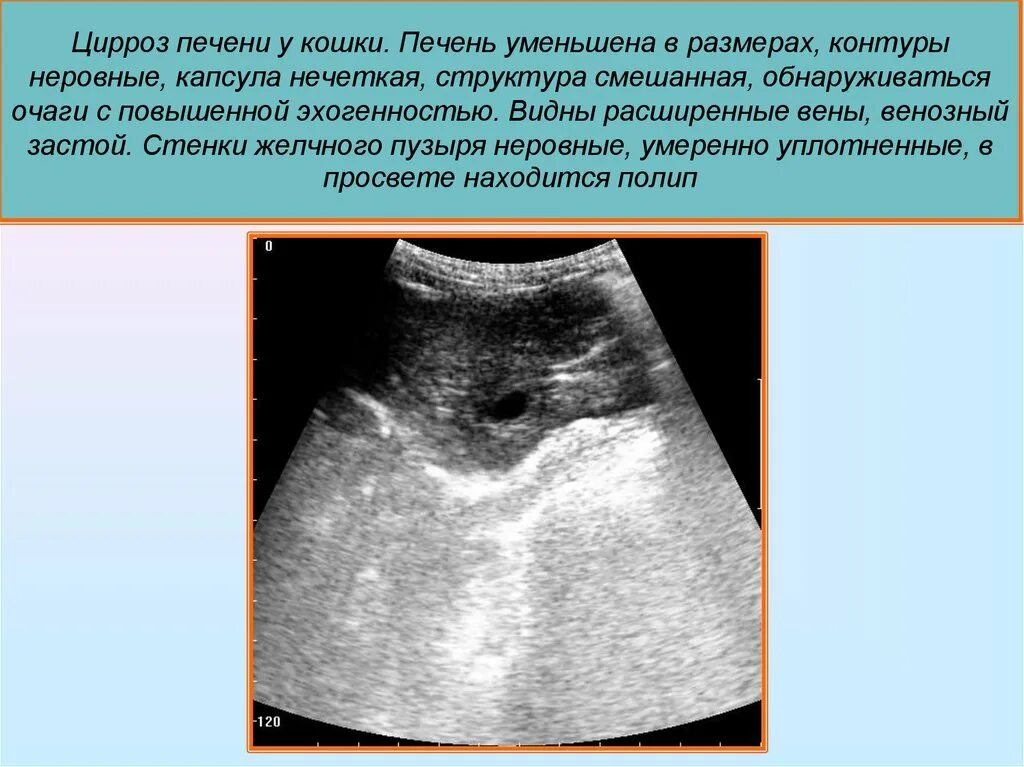 Может ли уменьшиться печень. Цирроз печени у животных. Цирроз печени у кошки УЗИ. Уменьшение размеров печени на УЗИ.