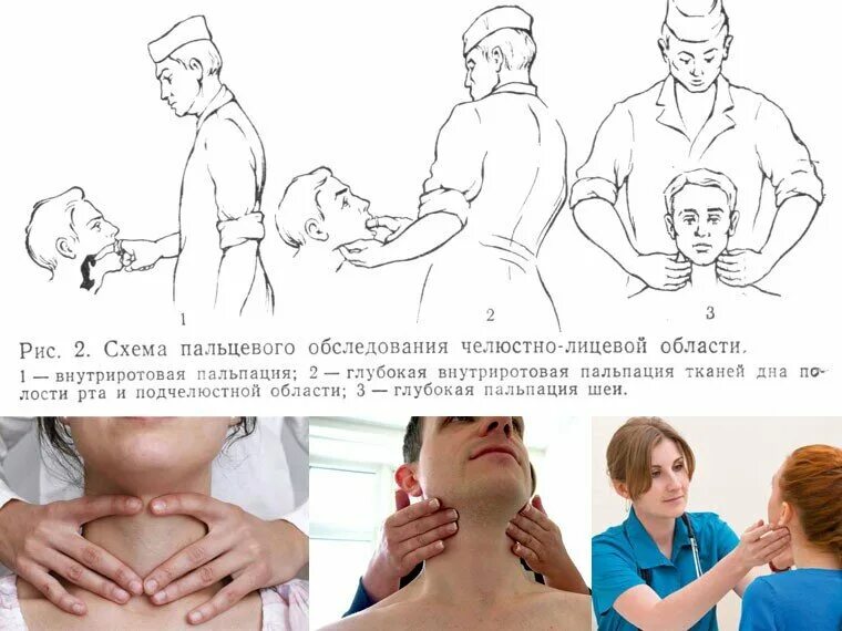 Обследование лимфоузлов. Пальпация регионарных лимфоузлов челюстно-лицевой области. пальпация лимфатических узлов. пальпация лимфоузлов в стоматологии. осмотр региональных лимфатических узлов.