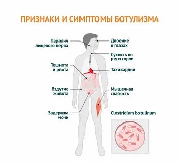 Боль в животе тошнота слабость головная боль
