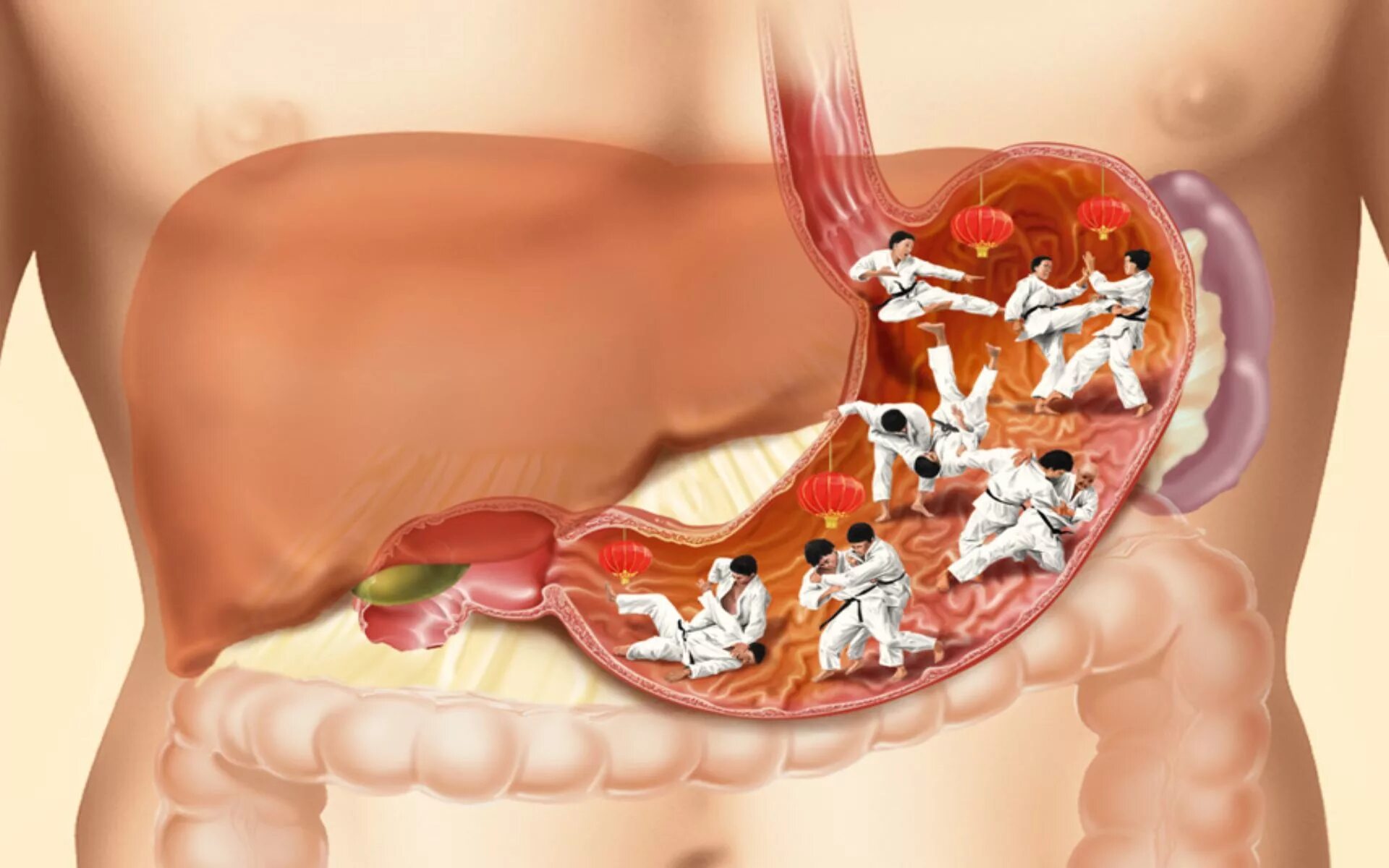 паразиты прямой кишки