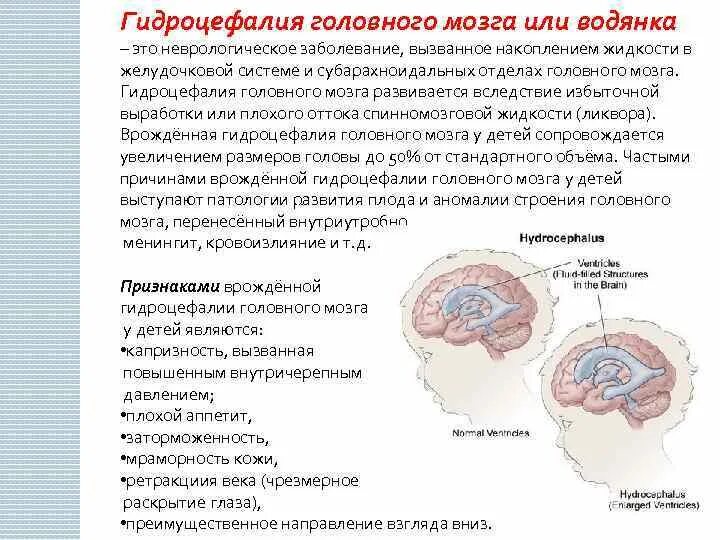 Как лечить гидроцефалию мозга