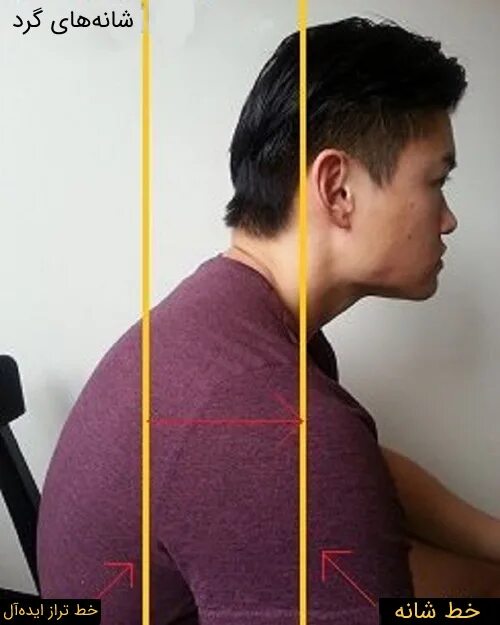 Round shouldered. Скругленные плечи. исправление скруглённых плеч. rounded shoulder posture.
