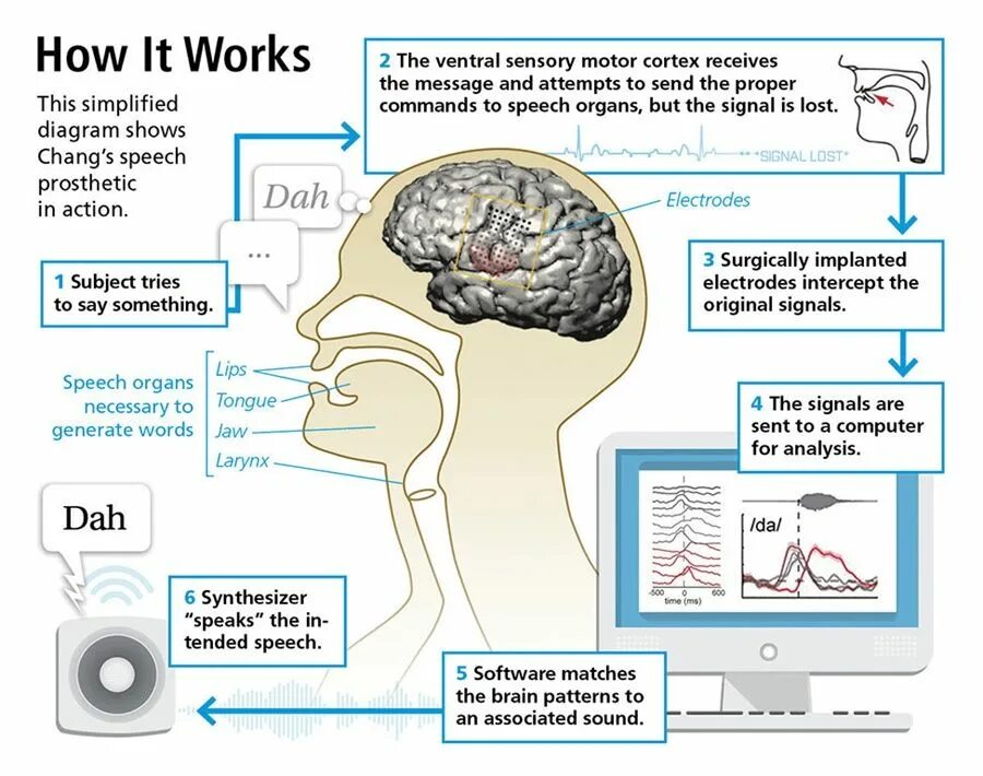 Speech brain