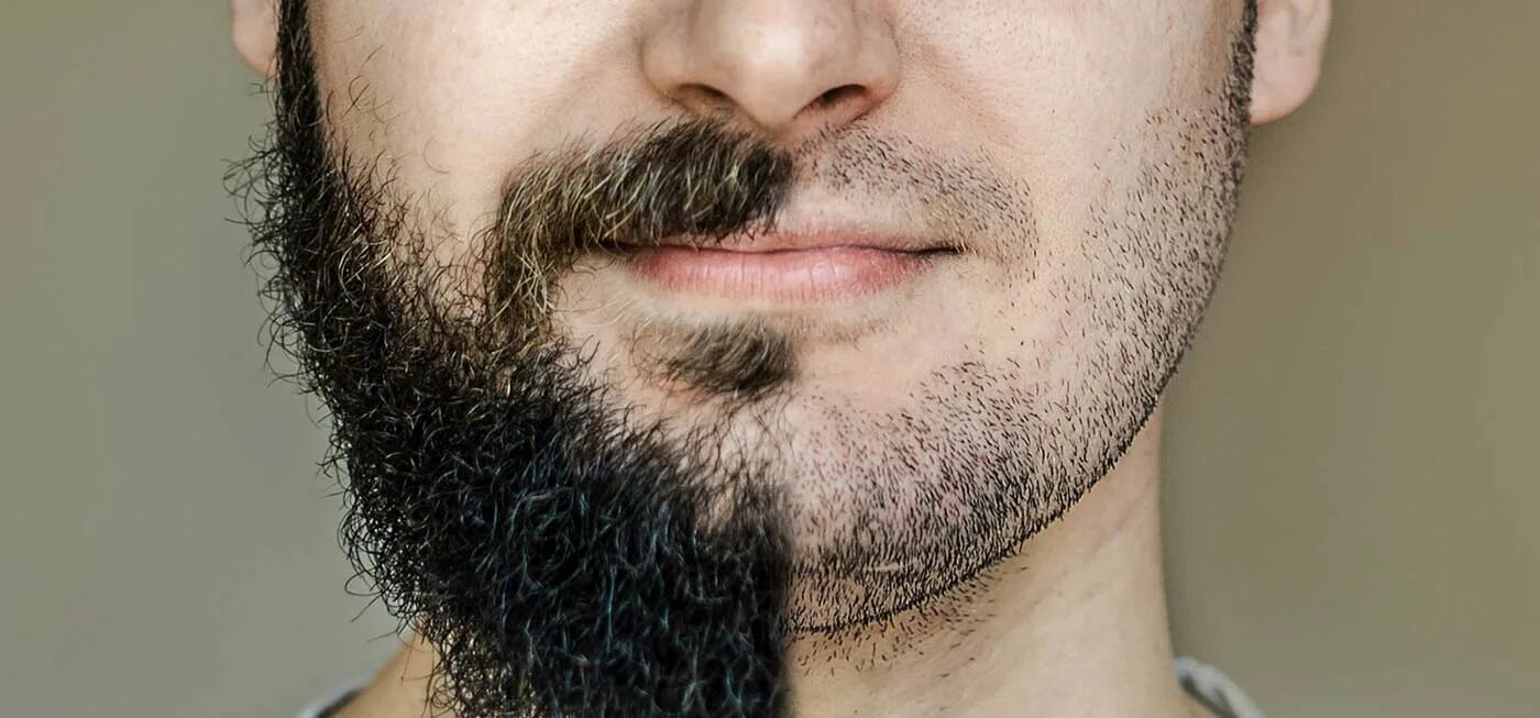 He has a beard