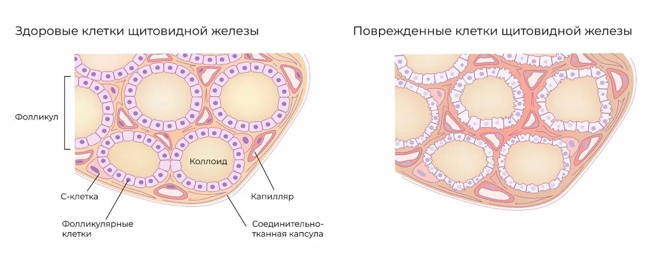 Фолликулы щитовидной железы гистология. Парафолликулярные клетки щитовидной железы. Тироциты фолликулярные клетки щитовидной железы. Строение фолликула щитовидной железы. Фолликул тироцита