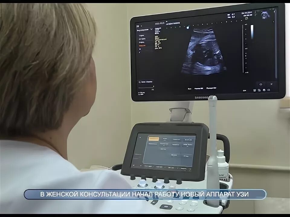 Узи в лабинске. Аппарат узи для женской консультации. узи в женской консультации. аппарат узи 4д. узи домодедово.