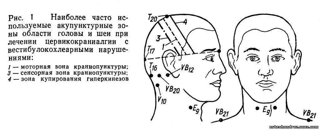 Температура затылка