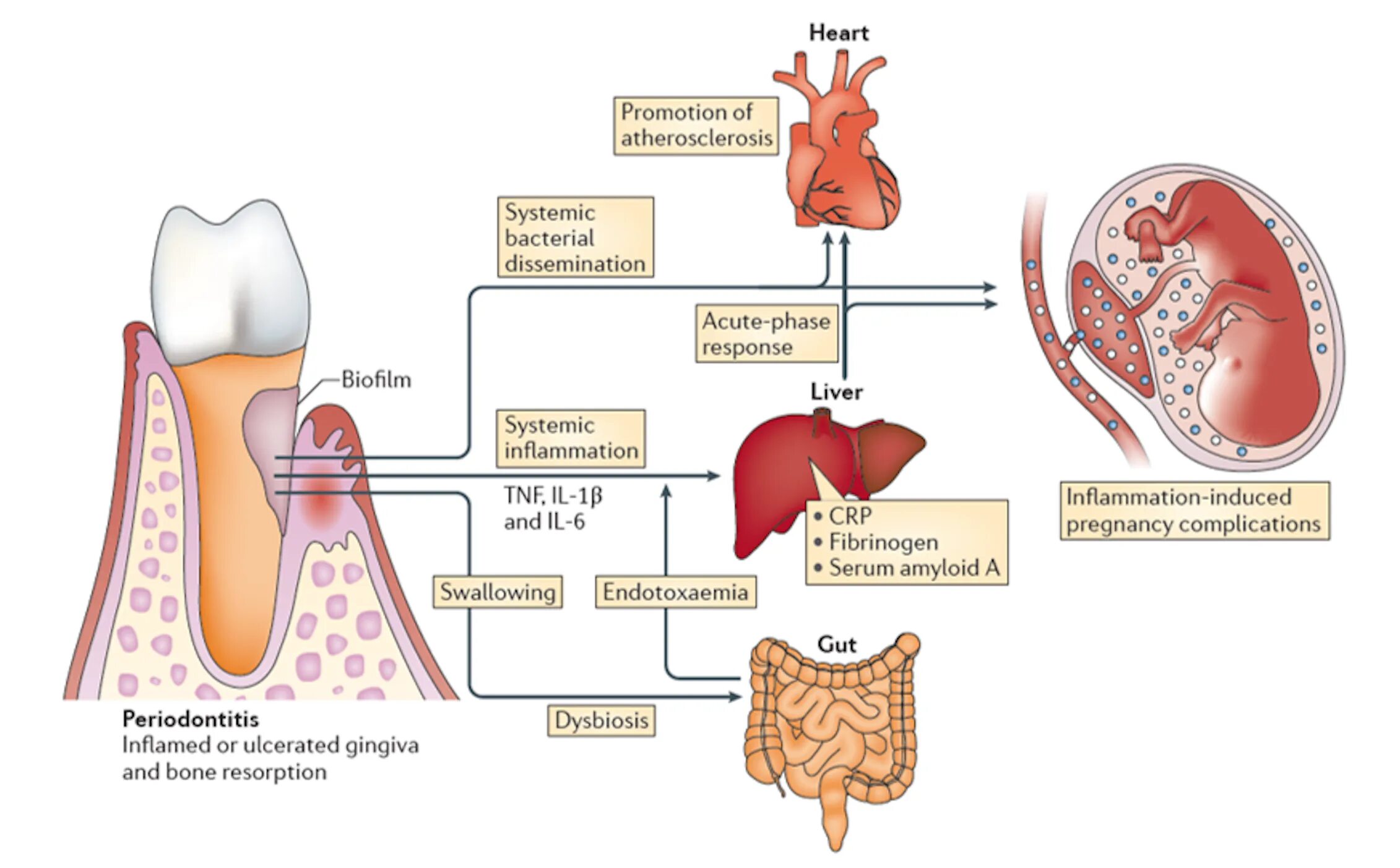 Микрофлора ротовой полости. Микробиота полости рта. Сердце и зубы взаимосвязь. Бактерии ротовой полости человека. Полость заболевания легких