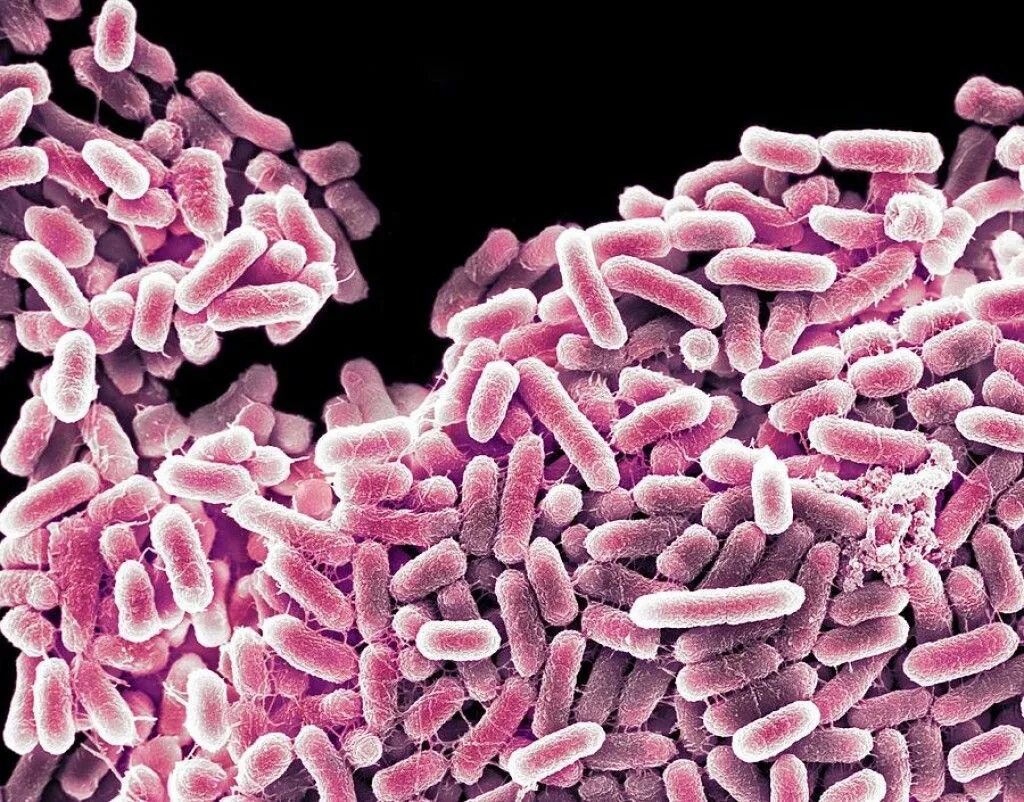 Salmonella enterica. Сальмонелла — бацилла. Сальмонелла Тифи под микроскопом. Сальмонеллез бактерия возбудитель. Сальмонеллез возбудитель сальмонелла.