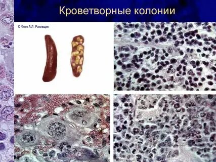 Какая ткань кроветворная