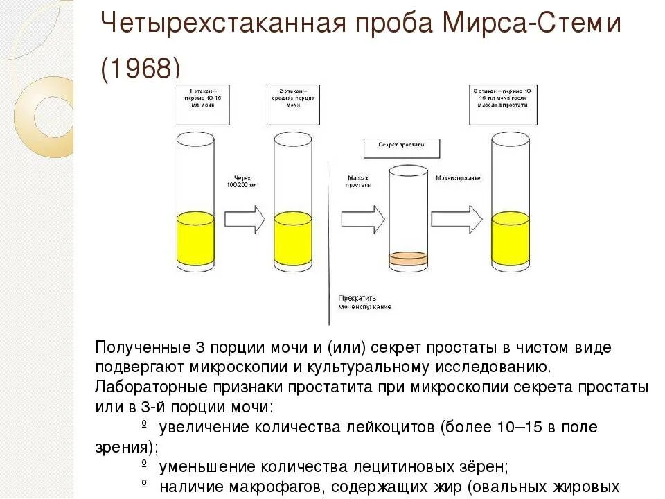 Трехстаканная проба мочи. Количество мочи для общего клинического анализа. Схема исследования мочи. Пробы мочи. Объем мочи для анализа.