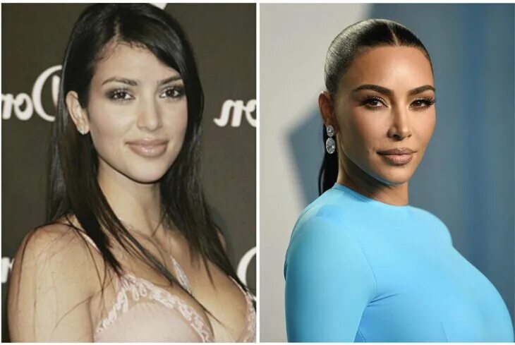Kim Kardashian Plastic surgery, Kardashian plastic surgery, Plastic surgery proc