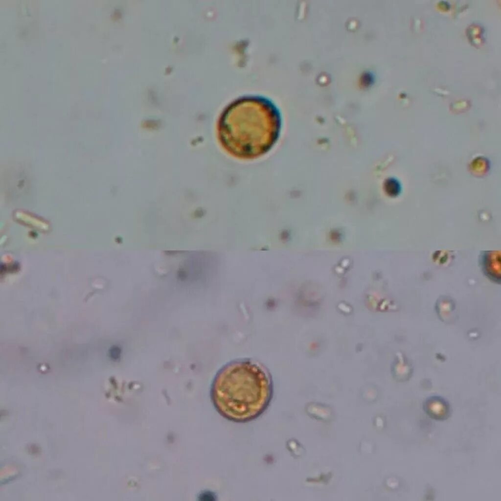 Цисты blastocistis Hominis. Blastocystis Hominis трофозоиты.