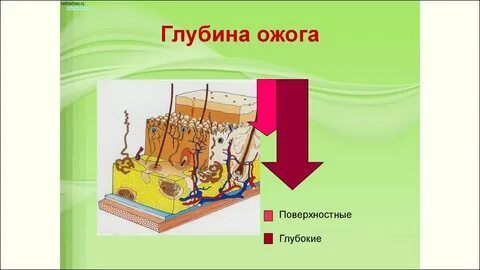 Глубина ожога
