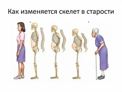 Различия женского и мужского скелета