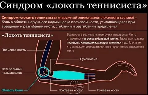 Почему синие локти