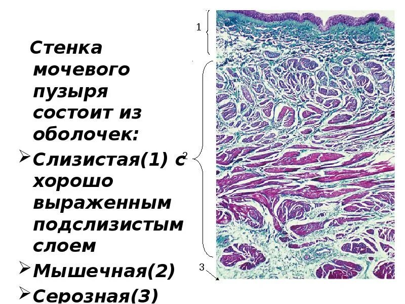 Стенка состоит из 3 оболочек. Стенка состоит из 3 оболочек