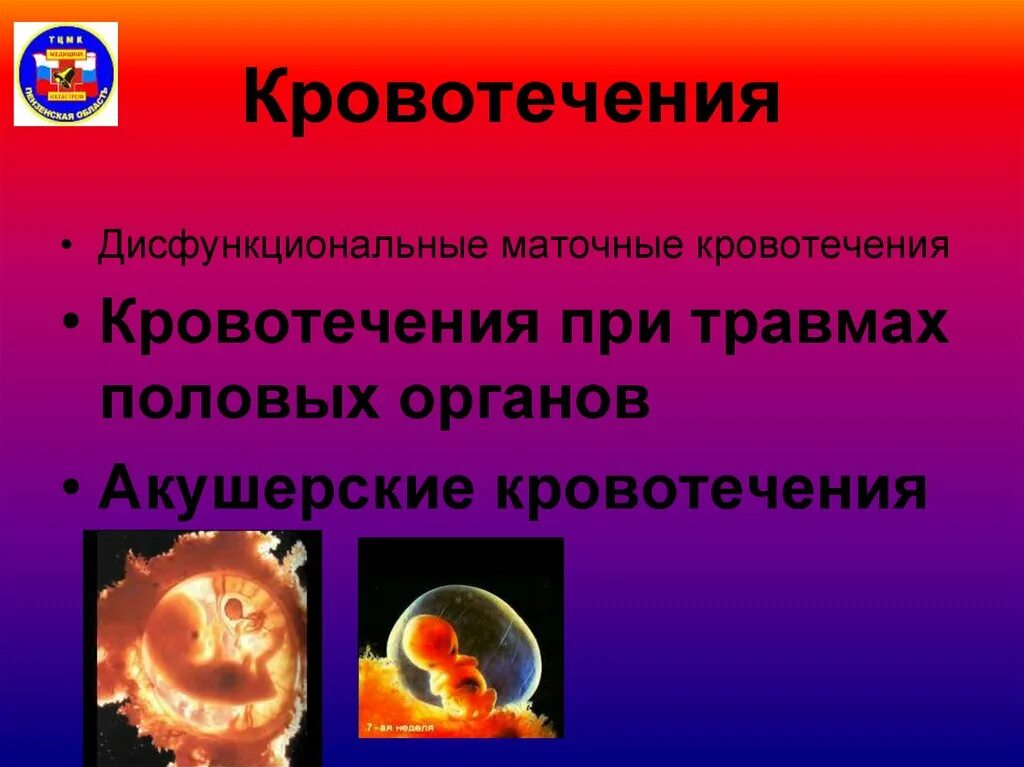 7 неделя кровотечение. Маточное кровотечение при травме. внутреннее кровотечение матки. неотложные состояния в акушерстве и гинекологии. маточные кровотечения травма.