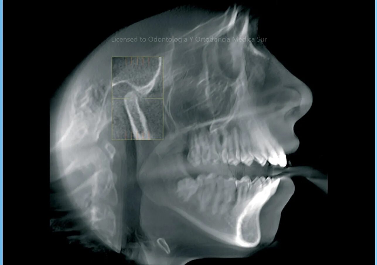 Снимок зубов видное. Кт суставов челюсти ВНЧС.