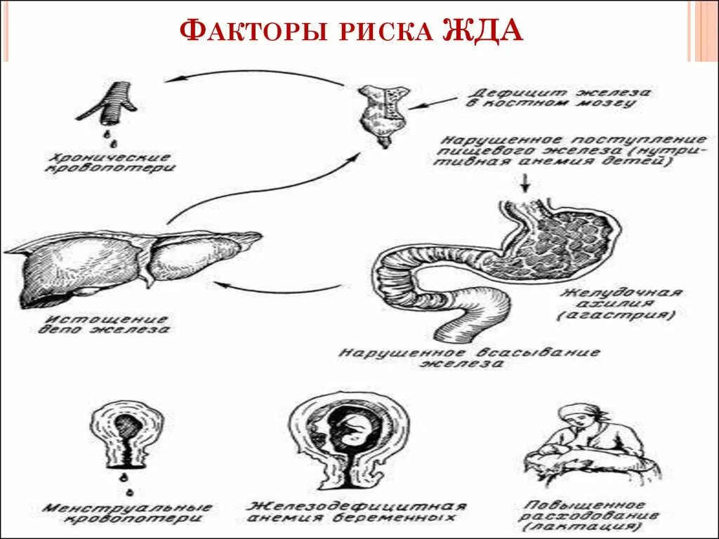 Факторы развития анемий. Факторы риска анемии. Факторы риска жда. Факторы риска анемии у детей.