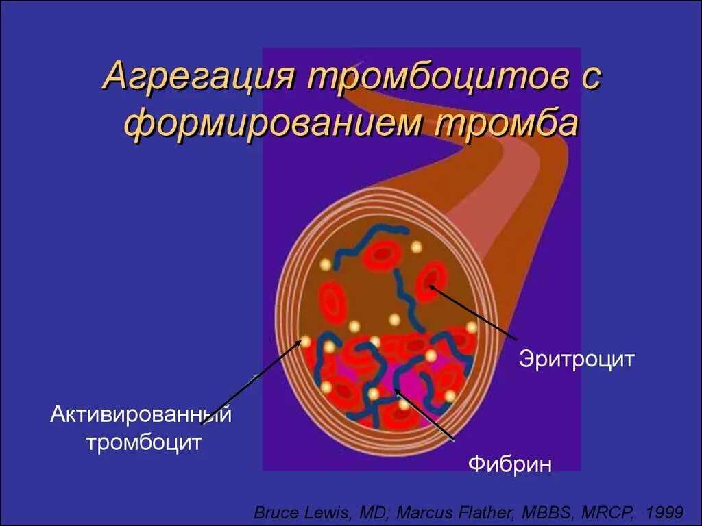 Адгезия и агрегация тромбоцитов. Процесс агрегации тромбоцитов. Повышение агрегации адгезии тромбоцитов. Агрегацию тромбоцитов индуцируют. Тромбоциты и тромбы