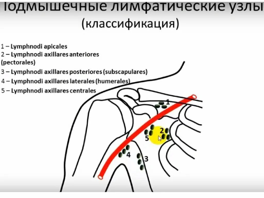 Лимфатические узлы подмышечной впадины топографическая анатомия. Подмышечные лимфоузлы расположение анатомия. Подмышечные лимфоузлы схема расположение. Лимфоузлы подмышечной области топография. Лимфоузлы кисти