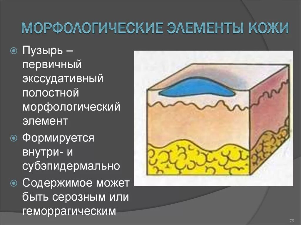 Вторичные элементы поражения. Первичные бесполостные морфологические элементы кожи. Вторичные морфологические элементы кожи Дерматовенерология. Волдырь первичный морфологический элемент. Морфологические элементы сыпи Дерматовенерология.