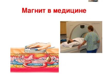 Применение магнитного поля в медицине