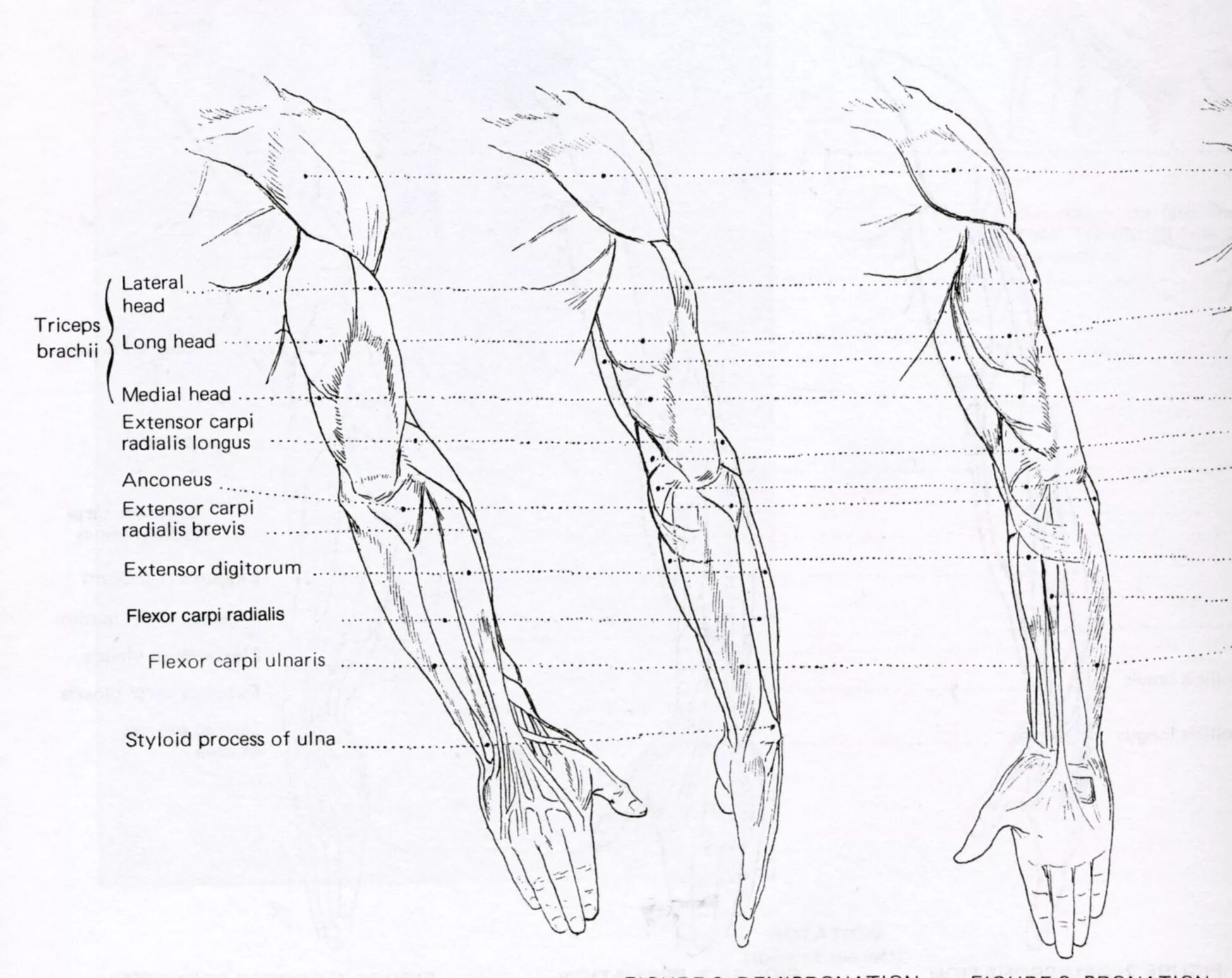 Строение руки рисунок. Анатомия мышц руки сбоку. Мышцы руки схема. Мышцы плеча и предплечья анатомия для художников. Мышцы руки анатомия человека.